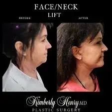 Breast Plastic Surgery Greenbrae - фото 1